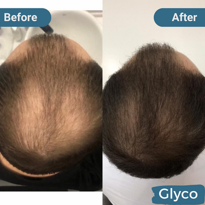 Glyco Hair Growth Cap