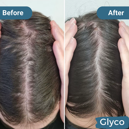 Glyco Hair Growth Cap